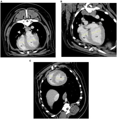 Utility of Computed Tomographic Angiography for Pulmonary Hypertension Assessment in a Cohort of West Highland White Terriers With or Without Canine Idiopathic Pulmonary Fibrosis